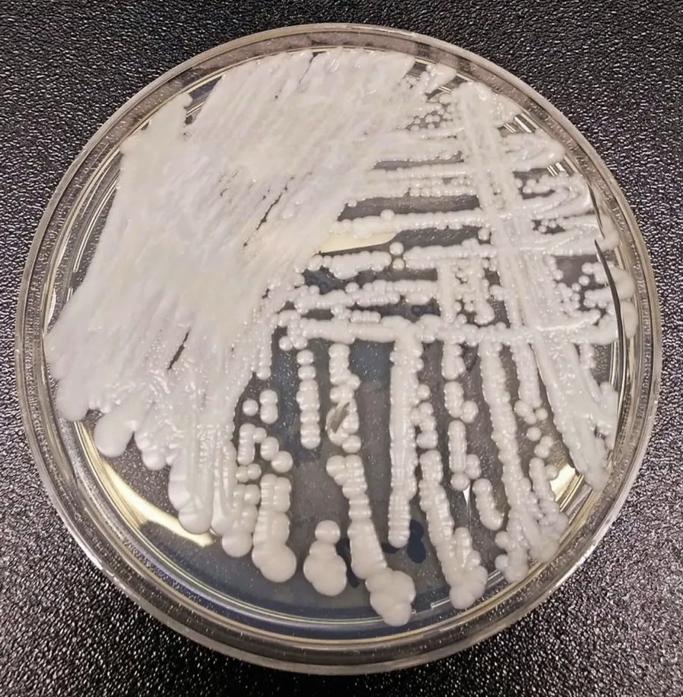 Fungo Candida Auris — Foto: Centers For Disease Control and Prevention (CDC)
