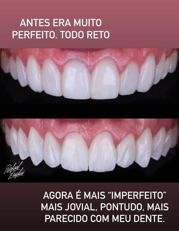 Gabriela Puglisi troca lentes de contato dos dentes (Foto: Reprodução/Instagram)