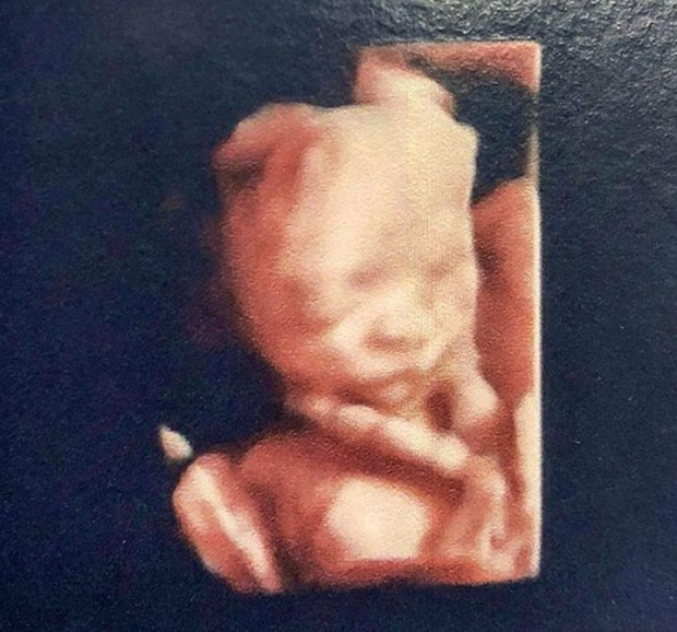Ultrassom do bebê de Bella Falconi (Foto: Reprodução/Instagram)
