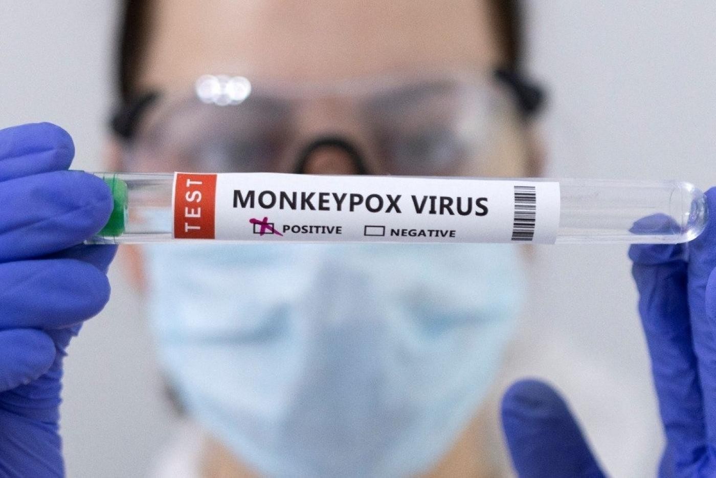 Sobe para 111 casos confirmados de varíola dos macacos no Amazonas