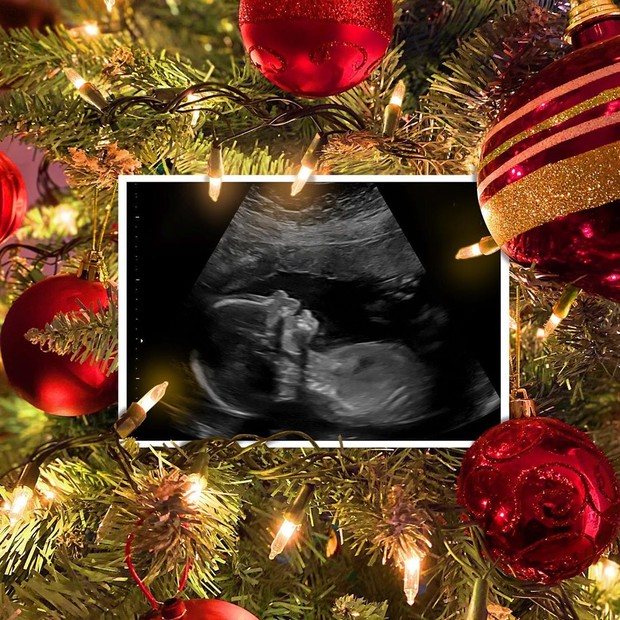 Meghan e Daryl anunciaram que estavam esperando seu primeiro filho no início deste mês (Foto: Reprodução )