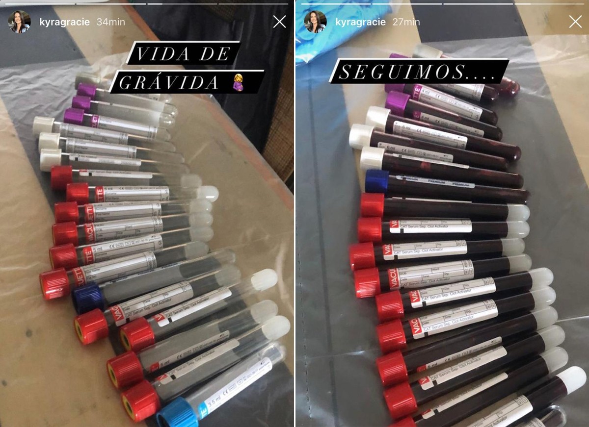 Kyra Gracie mostra exames de sangue para a gravidez (Foto: Reprodução / Instagram)