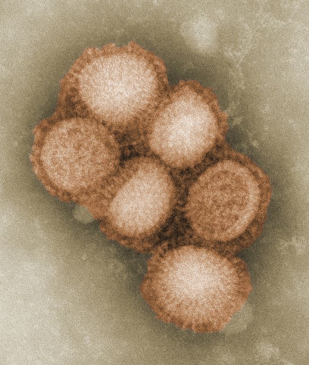 A/CA/4/09, o vírus da gripe suína. — Foto: CDC / C. S. Goldsmith and A. Balish