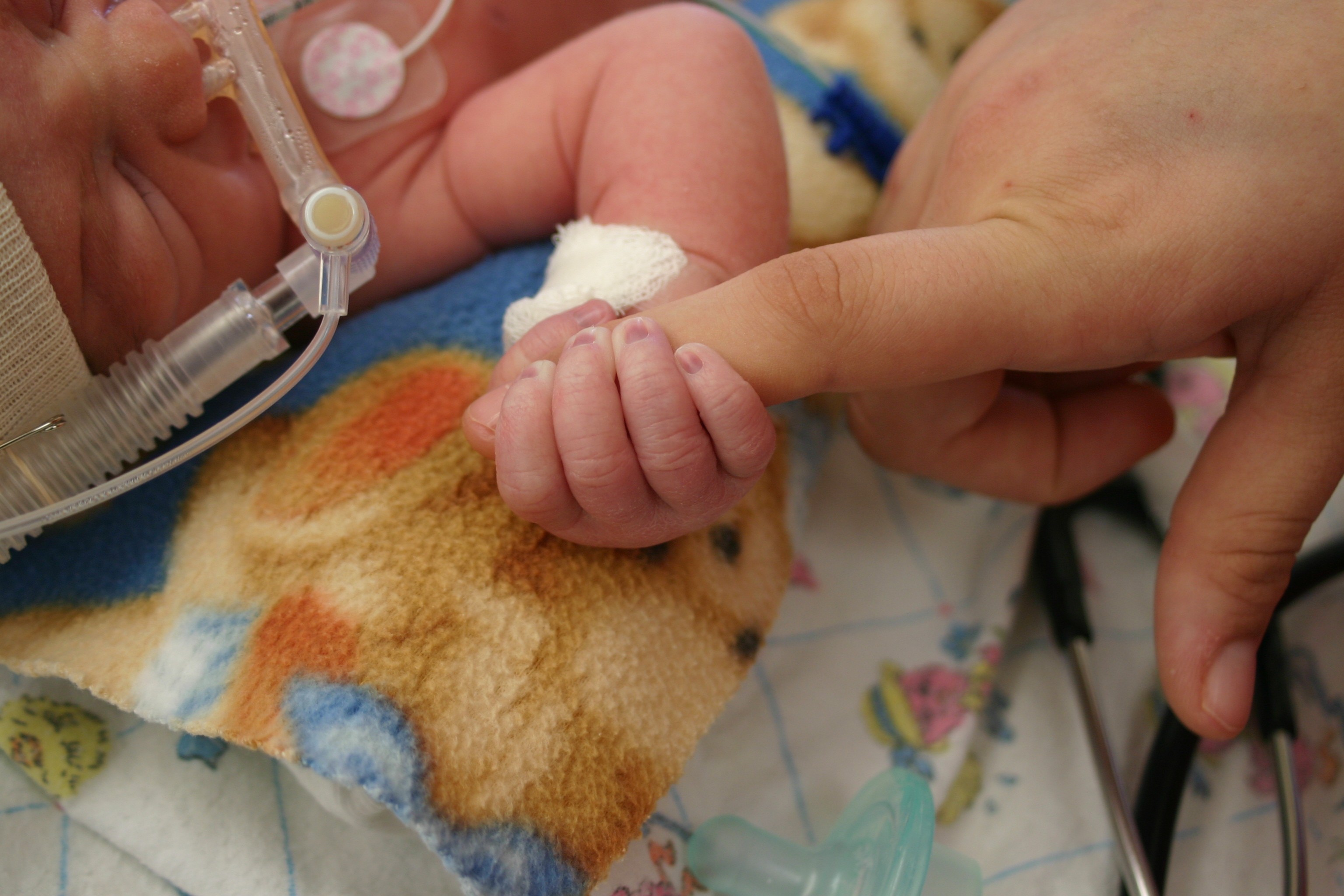 Bebê prematuro segurando mão de adulto (Foto: Getty Images)