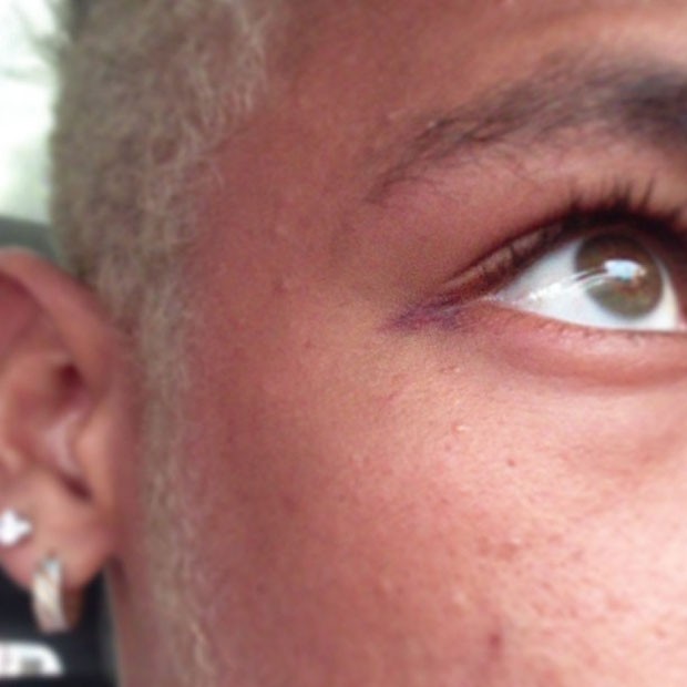 Neymar brinca com o machucado próximo do olho (Foto: Reprodução/Instagram)