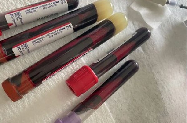 Os frascos com sangue compartilhados pela socialite Kourtney Kardashian (Foto: Instagram)