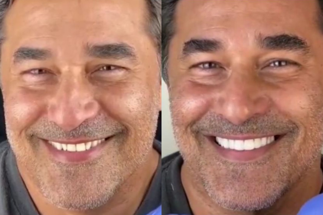 Luciano Szafir mostra antes e depois (Foto: Reprodução/Instagram)