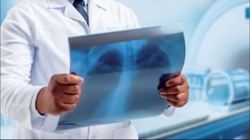 Exames de imagem convencionais, como a radiografia, muitas vezes não detectam essas lesões pulmonares (Foto: Getty Images)