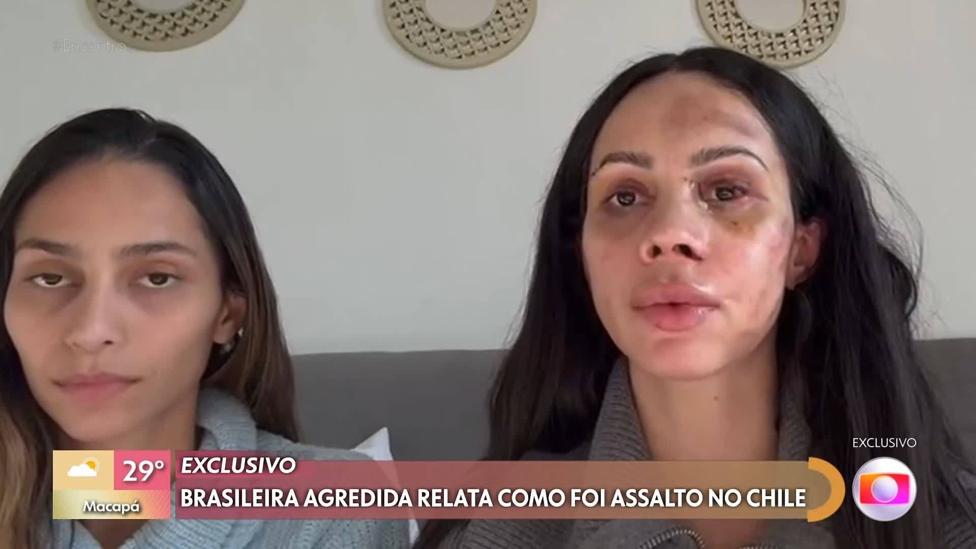 Vídeos Do Episódio De Encontro Com Patrícia Poeta De Quarta Feira 3