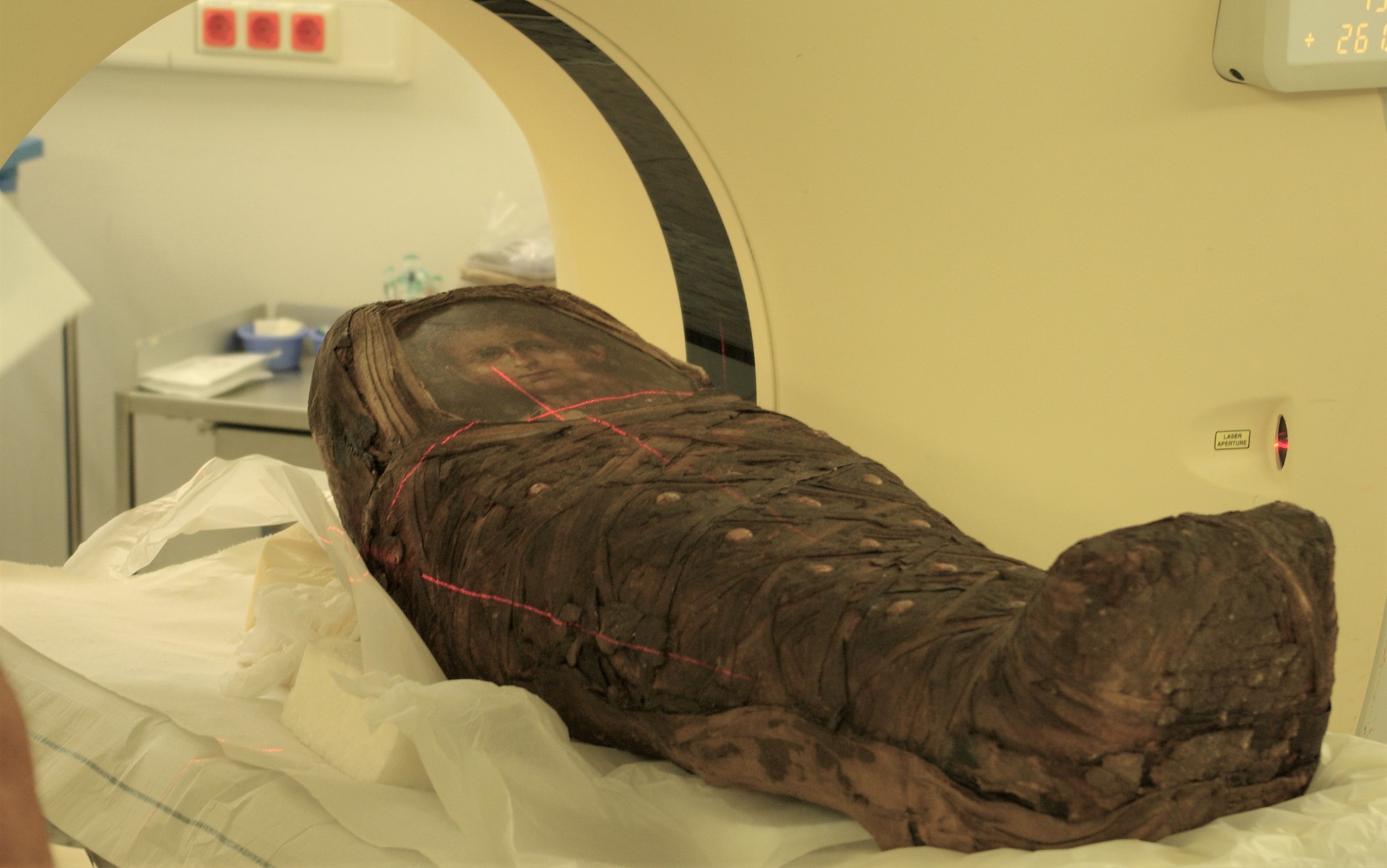 Pesquisadores escanearam múmia para reconstruir seu rosto compará-lo com pintura feita por artistas egípcios (Foto: Reprodução/Nerlich AG)