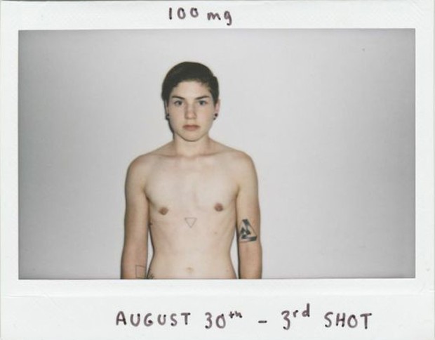 A terceira foto feita pelo artista, que anotou, no alto, a quantidade de testosterona a cada semana: 