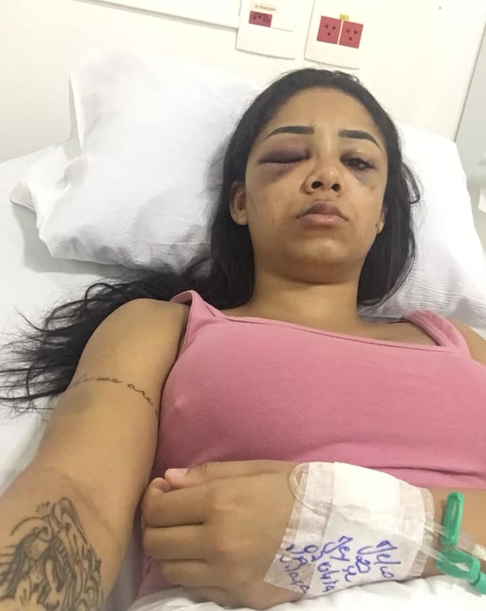 Jovem no hospital após agressão — Foto: Arquivo Pessoal