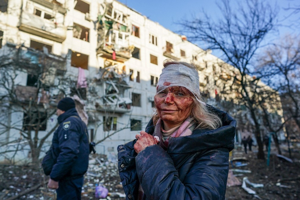 Mulher fica ferida após ataque aéreo danificar um complexo de apartamentos na cidade de Chuhuiv, Ucrânia, nesta quinta-feira (24) — Foto: Wolfgang Schwan/Anadolu Agency/Anadolu Agency via AFP