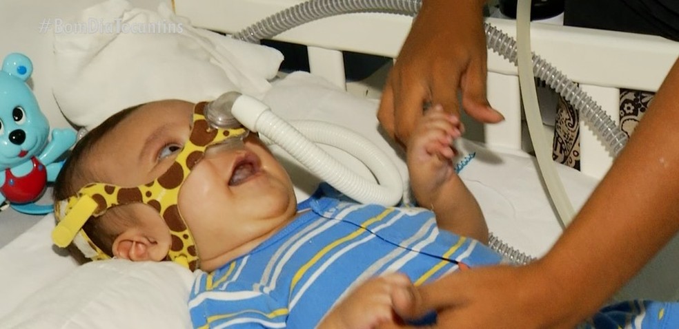 Bebê com AME precisa de medicamento que custa até R$ 12 milhões   — Foto: Reprodução 