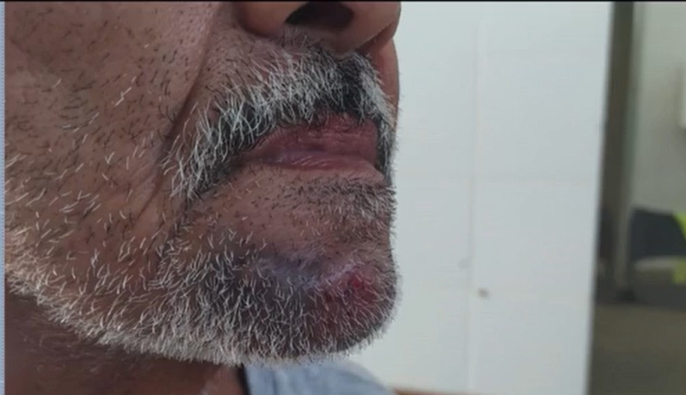 Idoso de 65 anos é agredido com tapas e socos por atendente de farmácia no sul da Bahia — Foto: Reprodução / TV Santa Cruz
