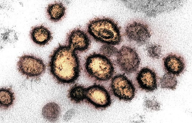 O coronavírus infecta células de gordura, indica estudo preliminar  (Foto: National Institute of Allergy and Infectious Diseases (NIAID))