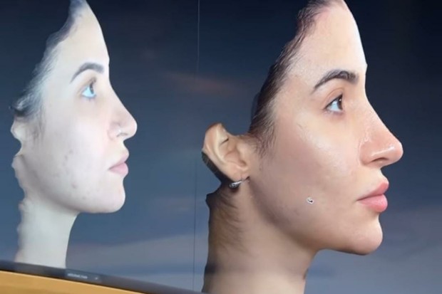 Bianca Andrade antes (em 2018) e depois (atualmente) da harmonização facial (Foto: Reprodução/Instagram)