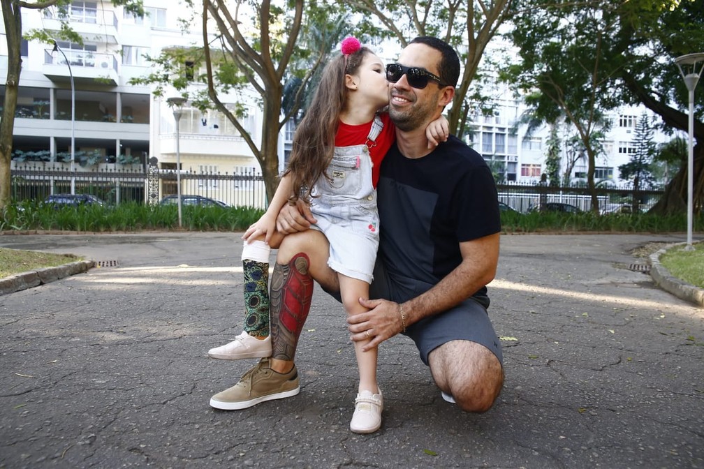 Pai Tatua Protese Na Perna Para Homenagear A Filha Um Jeito Descontraido De Ficar Igual A Ela Regiao Serrana G1
