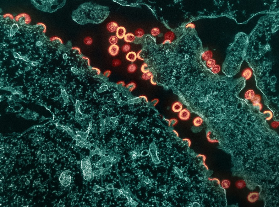 Vírus do HIV se replicando (em rosa) a partir de uma célula infectada (em verde).