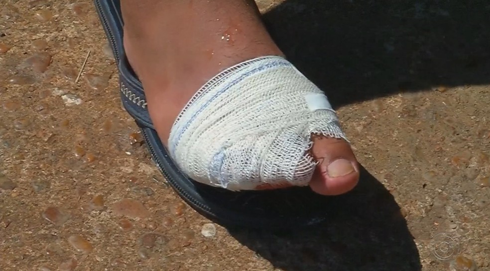 Banhista foi atacado por piranha na prainha do Rio Tietê em Pereira Barreto — Foto: Reprodução/TV TEM