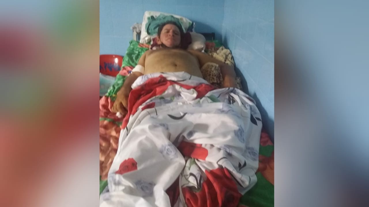 Por falta de documento, homem não consegue transferência para fazer cirurgia em Santarém