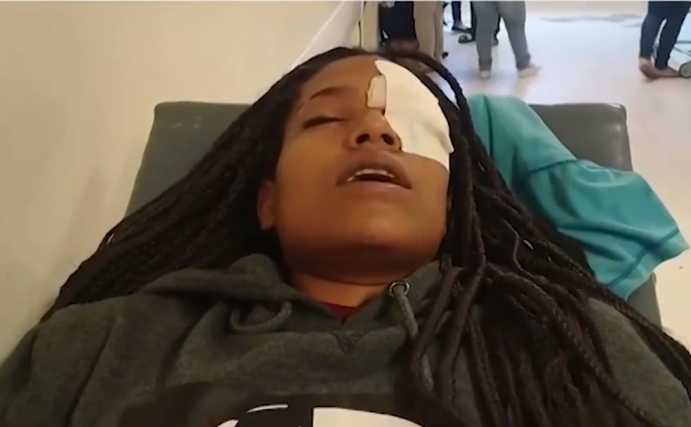 Jovem atingida no olho por bala de borracha durante confronto entre PMs e 'espadeiros' na Bahia perdeu a visão — Foto: Reprodução/TV Bahia