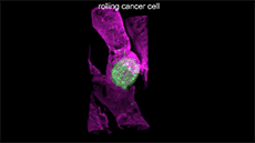 Célula cancerígena (Foto: Reprodução/ Science)