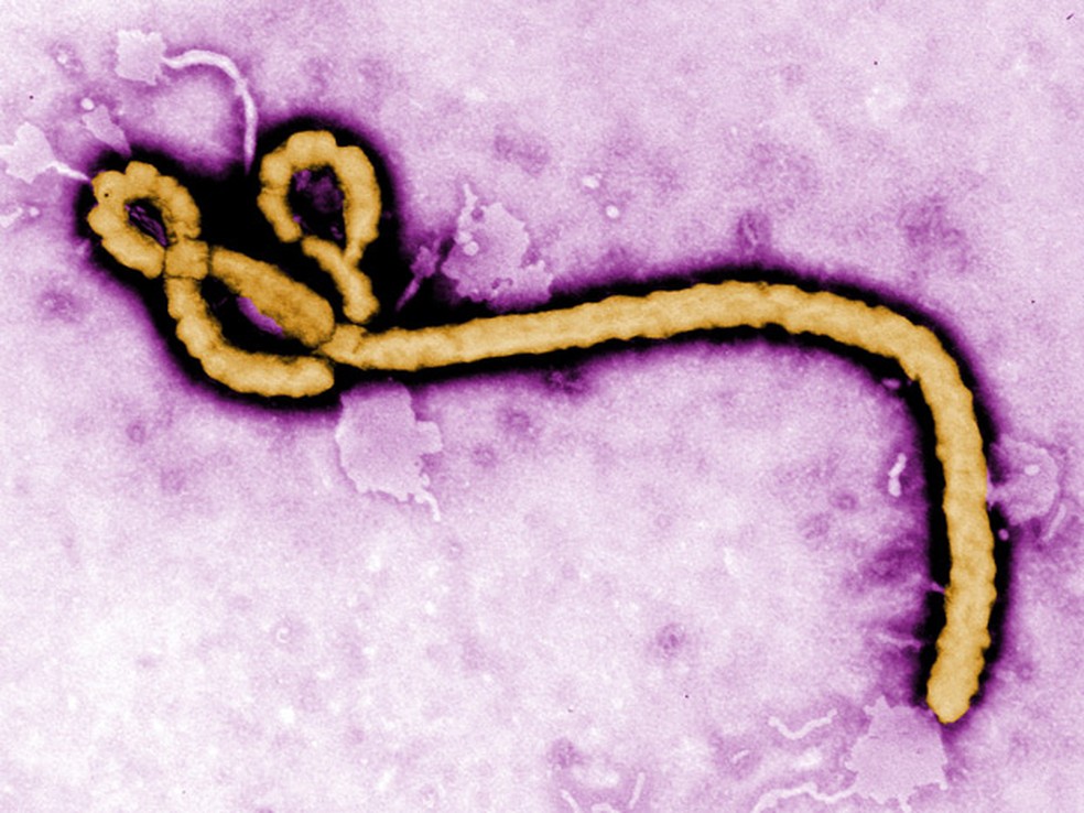 Imagem do vÃ­rus ebola observado em um microscÃ³pio eletrÃ´nico (Foto: Frederick Murphy/CDC via AP)