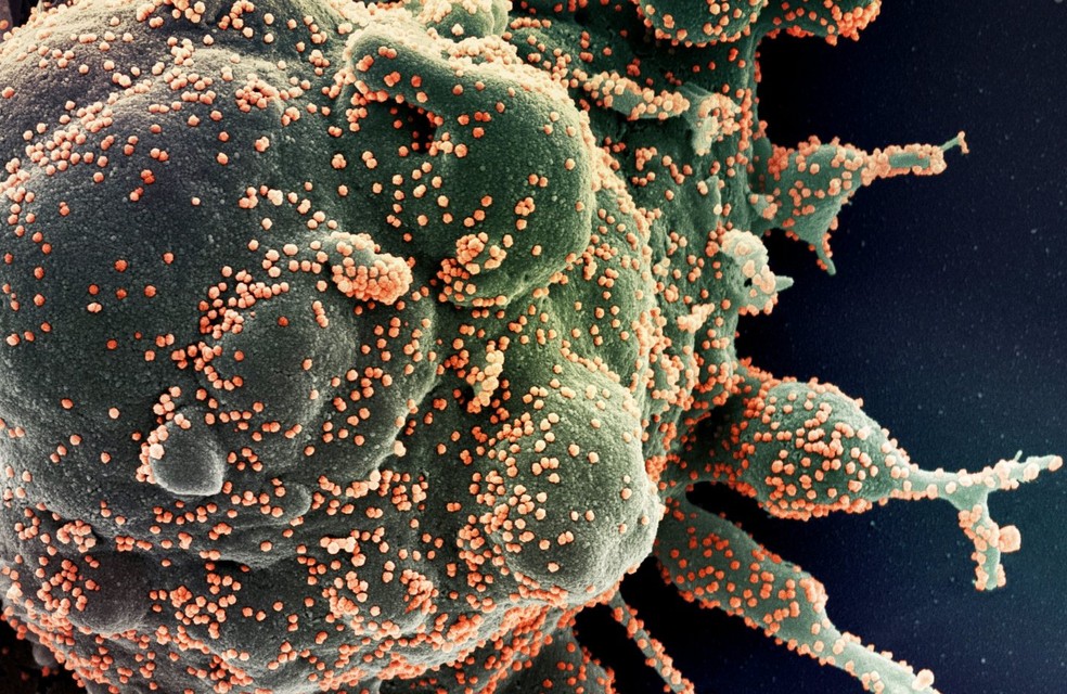 Foto microsc&oacute;pica mostra c&eacute;lula humana sendo infectada pelo Sars Cov-2, o novo coronav&iacute;rus &mdash; Foto: NIAID via Nasa