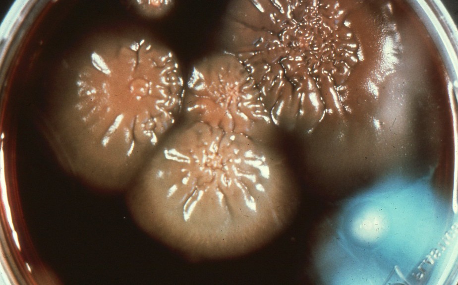 Colônias do fungo 'Blastomyces dermatitidis' em placas de ágar sangue incubadas a 30ºC