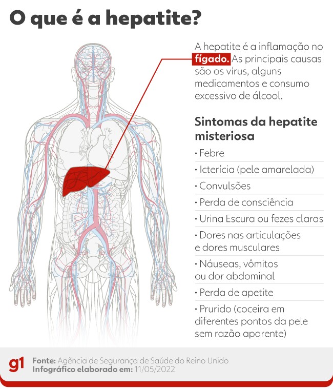 Ceará investiga um caso de hepatite de causa desconhecida, diz secretaria