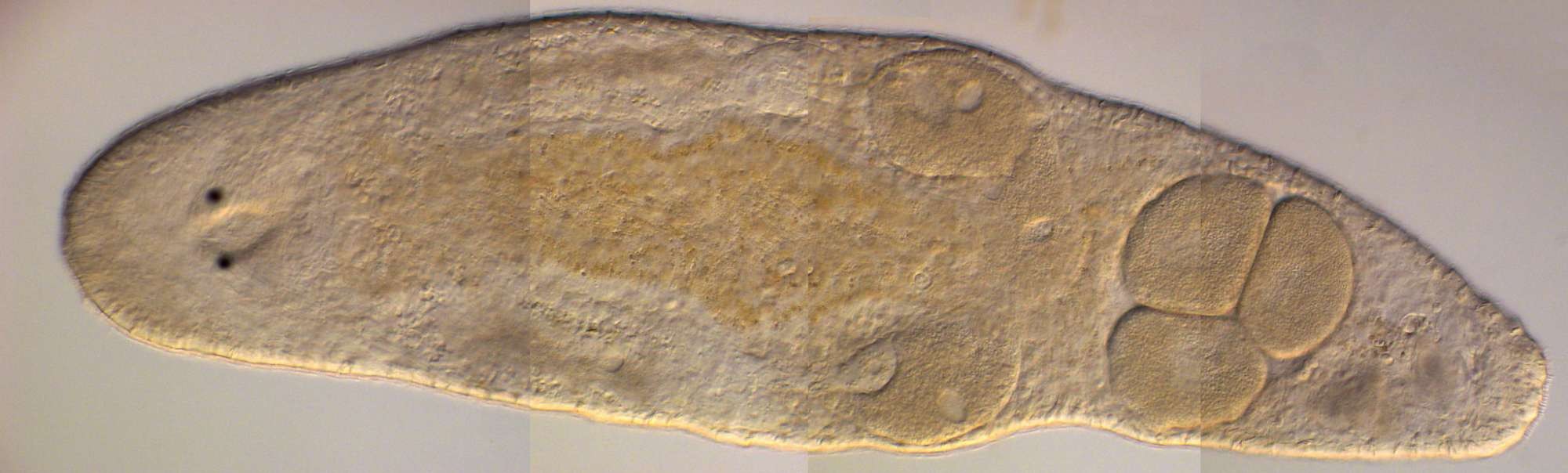 Macrostomum hystrix (Foto: wikimedia commons)