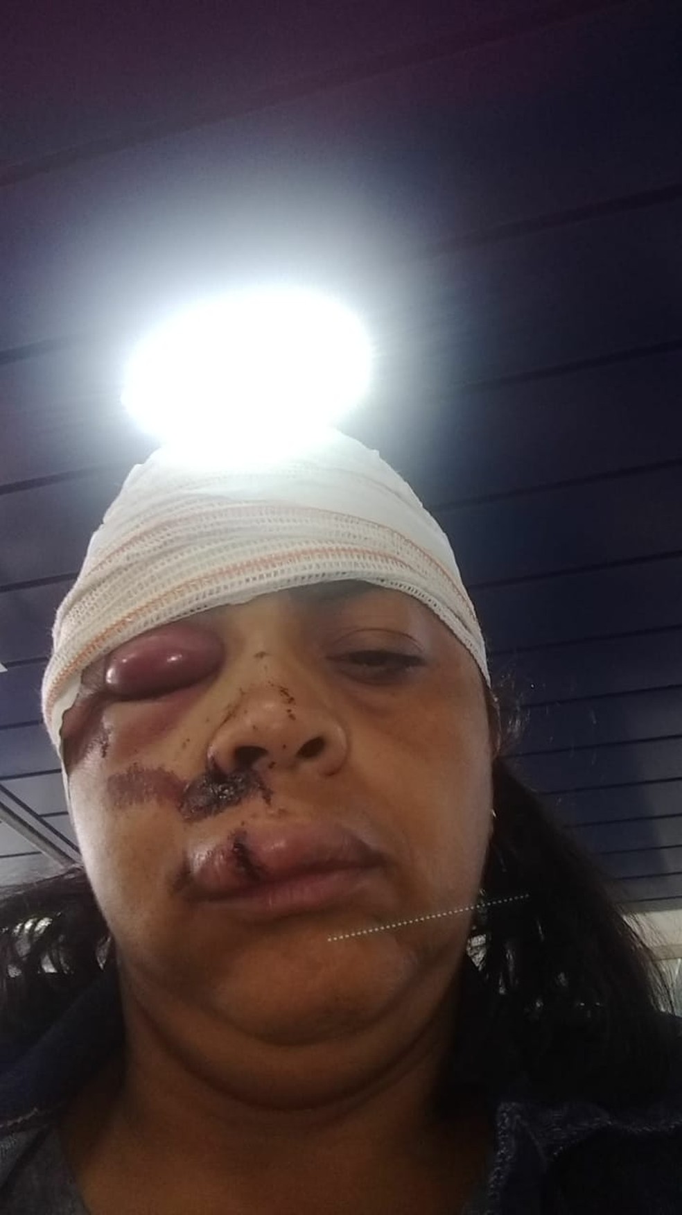 Mulher ficou ferida apÃ³s ser vÃ­tima de assalto em GuarujÃ¡, SP â Foto: Arquivo pessoal