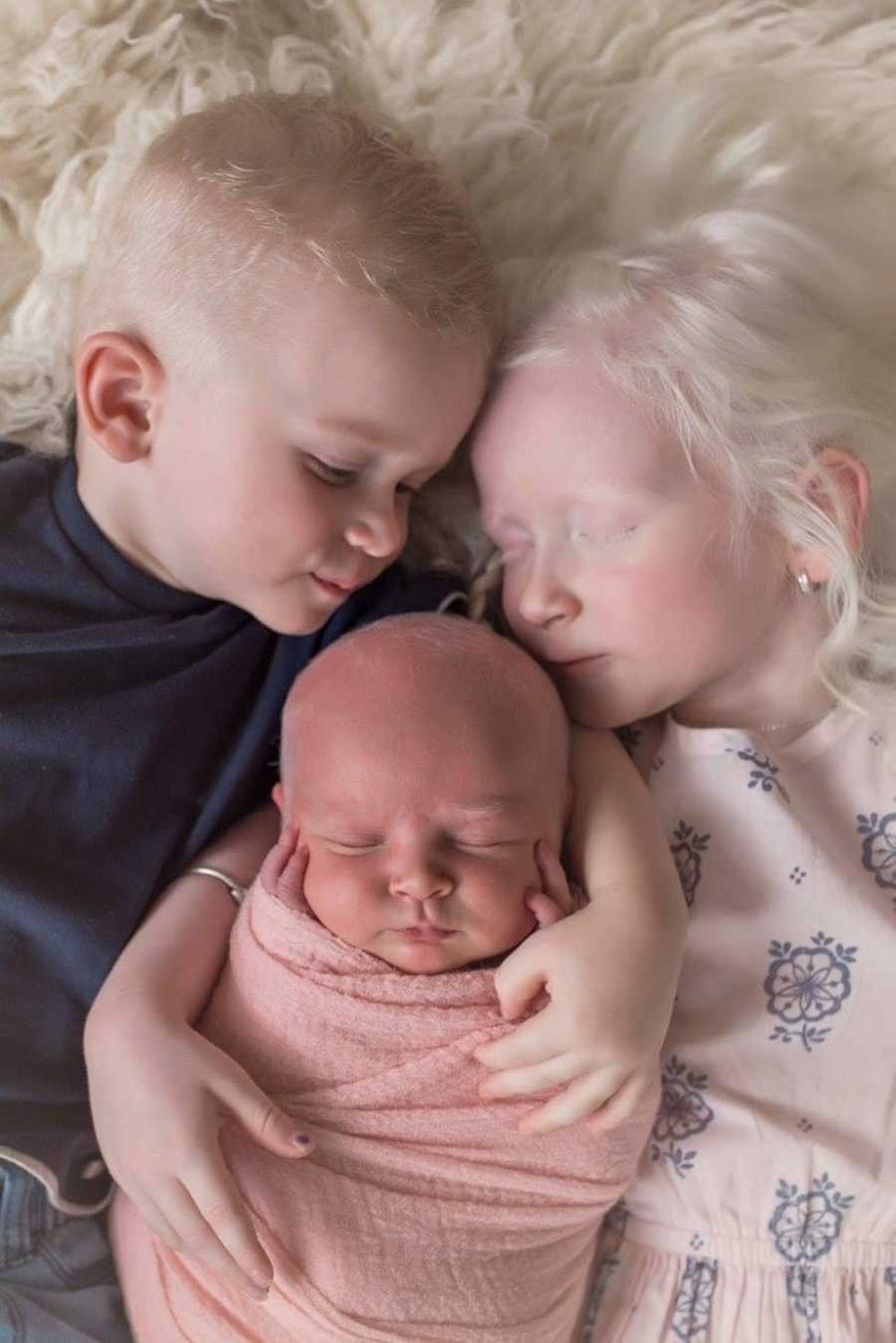 As duas irmãs foram diagnosticadas com albinismo e o irmão está fazendo investigação para diagnóstico de Transtorno do Espectro Autista (TEA) (Foto: Reprodução/Love What Matters)
