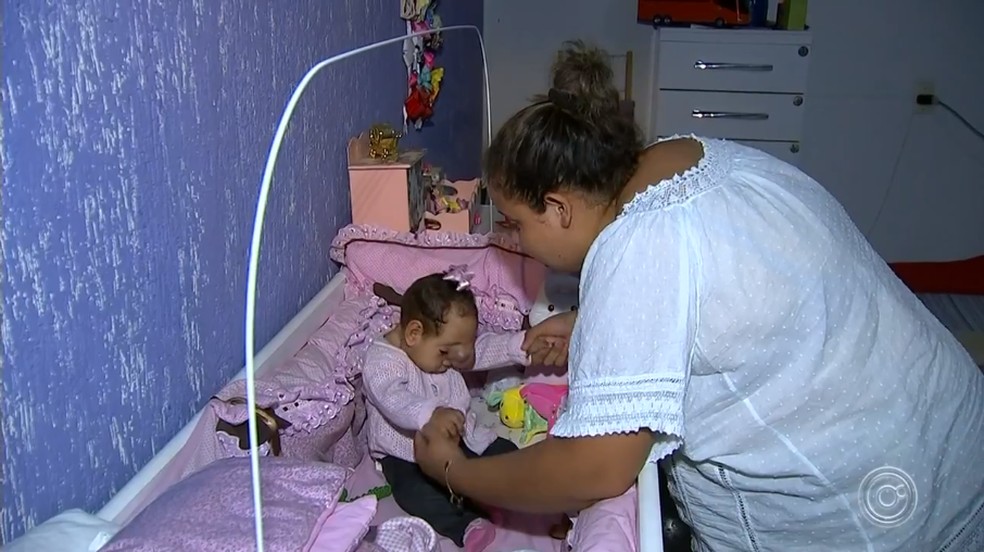 Família Faz Campanha Para Conseguir Cirurgia De Bebê Que Nasceu Com Cérebro Fora Do Crânio 8810