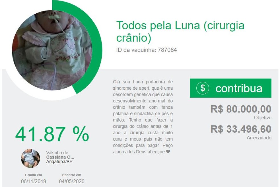 Família criou vaquinha na web para arrecadar R$ 80 mil para cirurgia de Luna, bebê de Angatuba (SP) — Foto: Reprodução/Vakinha