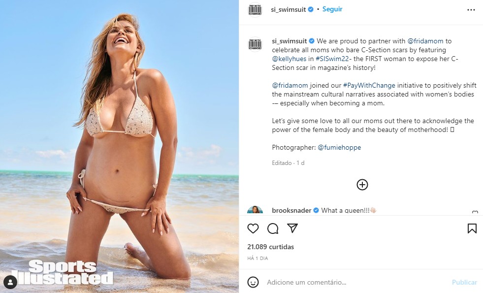 Revista traz modelo exibindo cicatriz de cesárea (Foto: Reprodução/Instagram/Sports Illustrated Swimsuit)