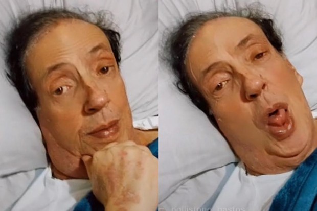 Marcos Oliveira, o Beiçola da Grande Família, ainda fará mais uma cirurgia (Foto: Reprodução/ Instagram)