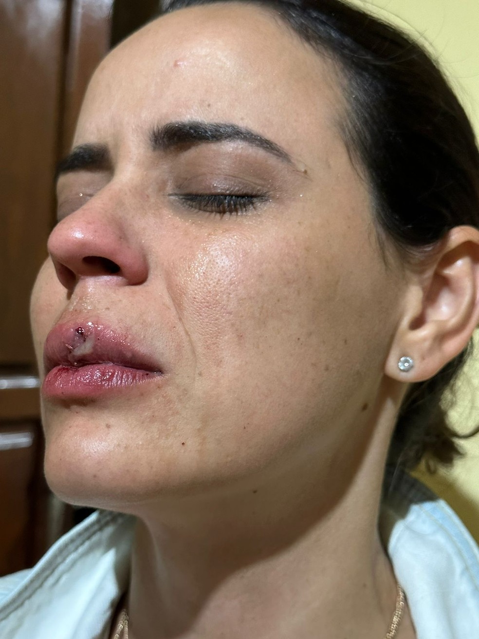 Fotógrafa Bruna Andrade foi agredida durante festa em Brasilândia de Minas — Foto: Redes sociais