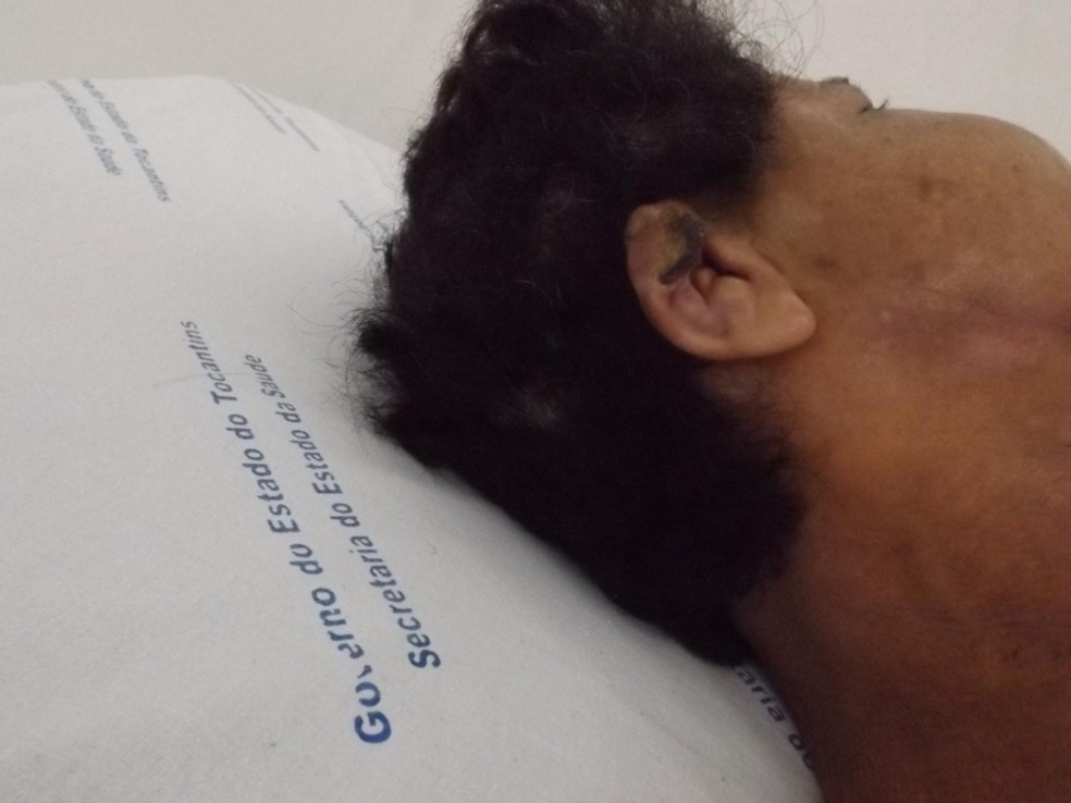 Uma das orelhas machucadas pelas mordidas, não pode ser reconstruída — Foto: Marcelo Gris/GuaraíNotícias