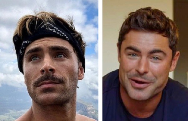 Zac Efron aparece com rosto diferente e fãs o comparam com