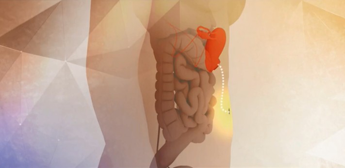 Técnica cirúrgica de transposição uterina desenvolvida em Curitiba dá esperança para mulheres que desejam engravidar após tratamento de câncer