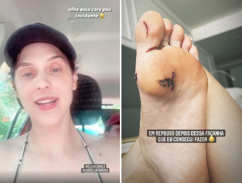 Sophia Abrahão mostra cortes no pé após desmaio (Foto: Reprodução/Instagram)