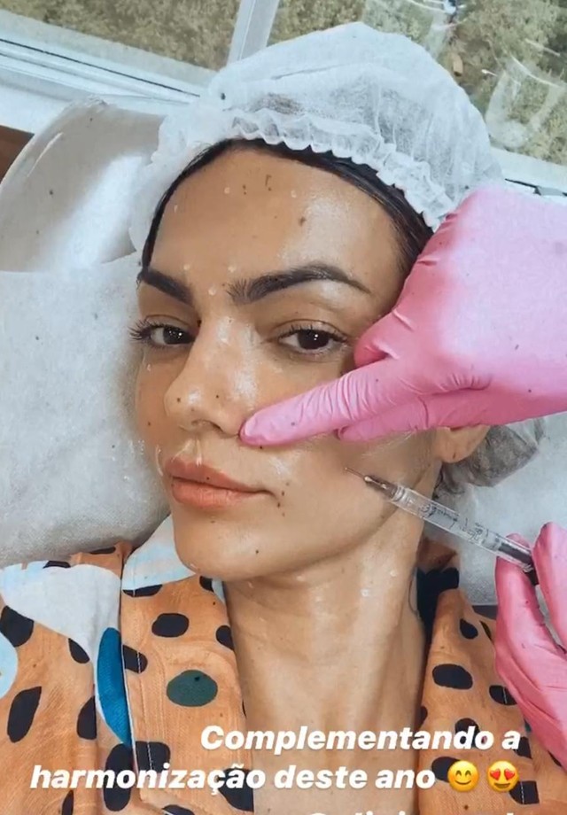Kelly Key faz novo procedimento estético facial (Foto: Reprodução/Instagram )