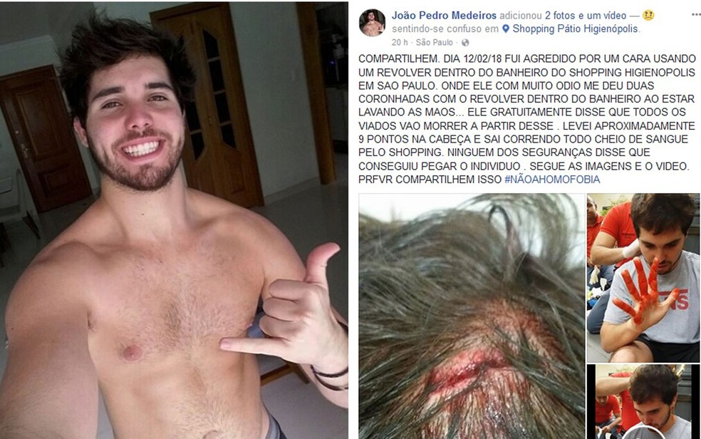 João Pedro Moreira postou no Facebook relato e imagens do ataque que sofreu no shopping Pátio Higienópolis (Foto: Reprorudução/Facebook)