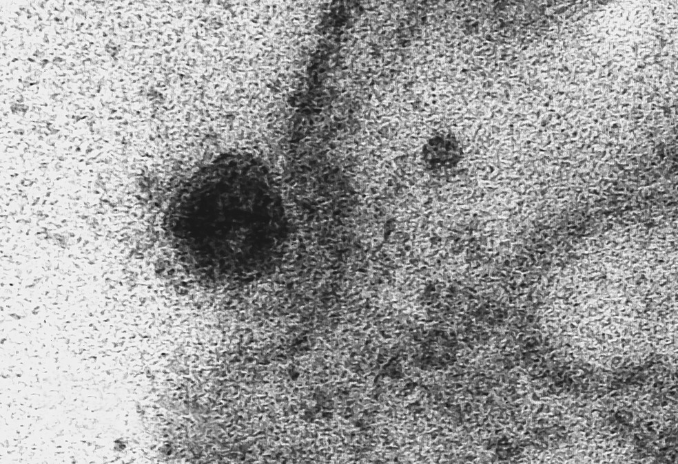 Imagem de microscopia mostra à esquerda o Sars-Cov-2, o novo coronavírus, atacando a membrana de uma célula. Esfera escura à esquerda — Foto: IOC/Fiocruz