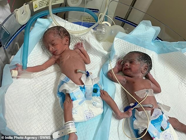 Gêmeos nasceram saudáveis (Foto: Reprodução)