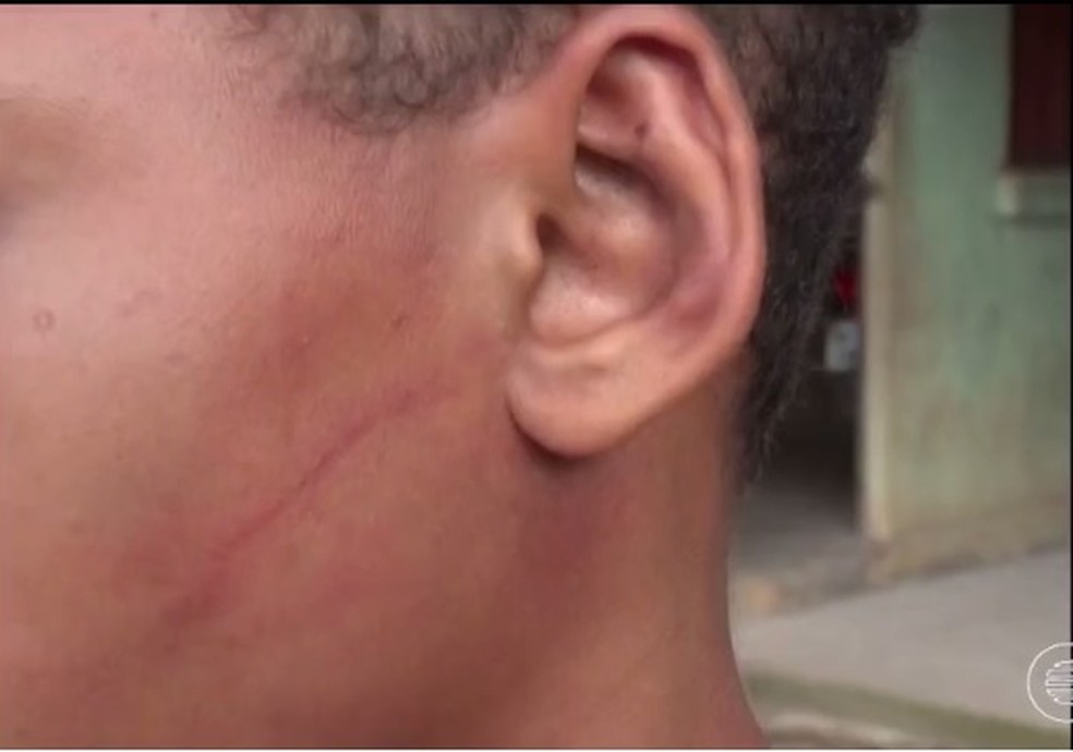 Adolescente teria sido torturado em Floriano (Foto: Reprodução / TV Clube)