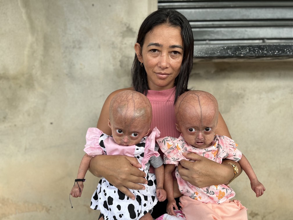 Elismar é a mãe de Eliz e Eloá, que podem ser as primeira gêmeas diagnosticadas com progéria no Mundo — Foto: Caíque Rodrigues/g1 RR