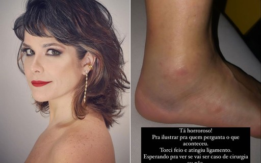 Samara Felippo mostra o pé inchado após torção: "Esperando para ver se vai ser caso de cirurgia"